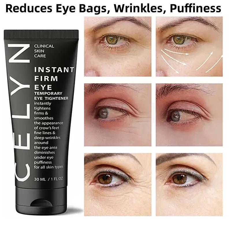 Celyn Dark Circles Cream