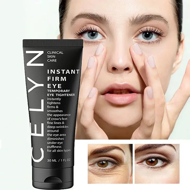 Celyn Dark Circles Cream